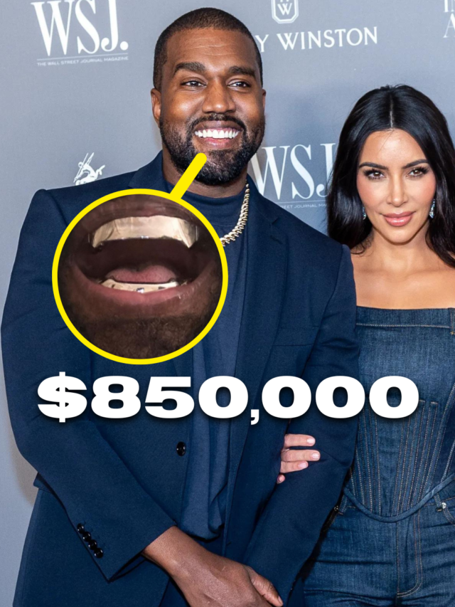 Kanye West Teeth’s Now Worth $850,000